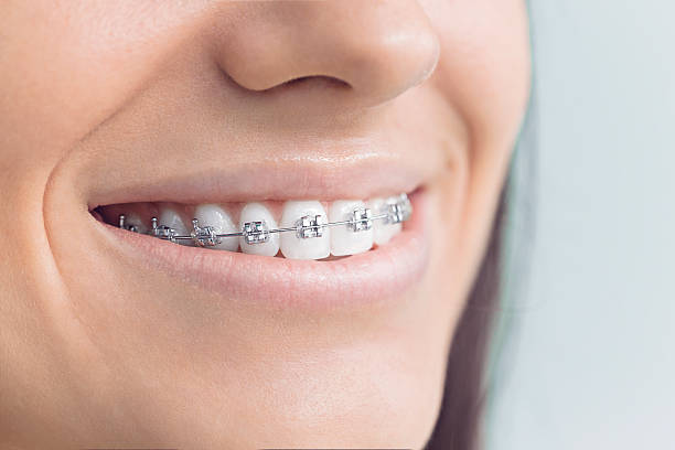 Best Wisdom Tooth Removal  in Steele, MO